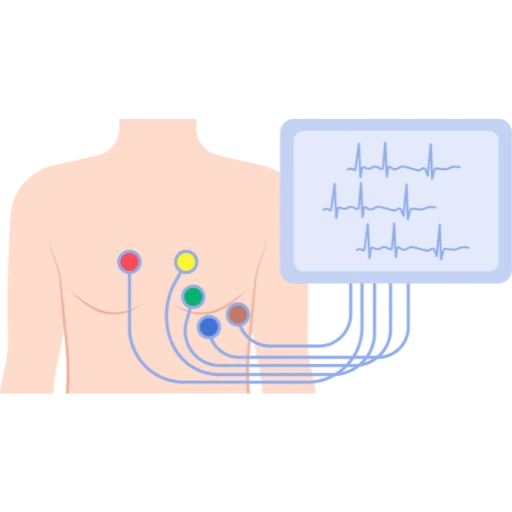 holter cardiaco a domicilio